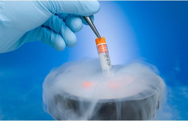 Worried About Fertility Preservation? Here's How an IVF Center in Noida Can Help Manage Egg Freezing Costs